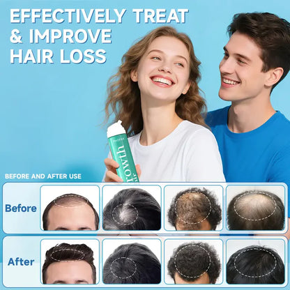 PHOFAY Minoxidil Anti-Hair Loss Mousse