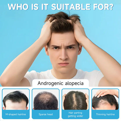 PHOFAY Minoxidil Anti-Hair Loss Mousse