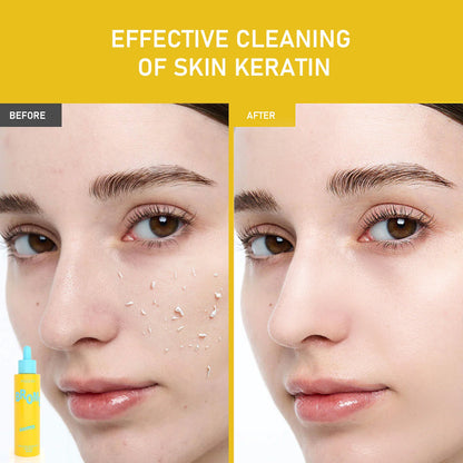 PHOFAY Exfoliating Set